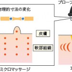 超音波治療①