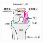タナ障害